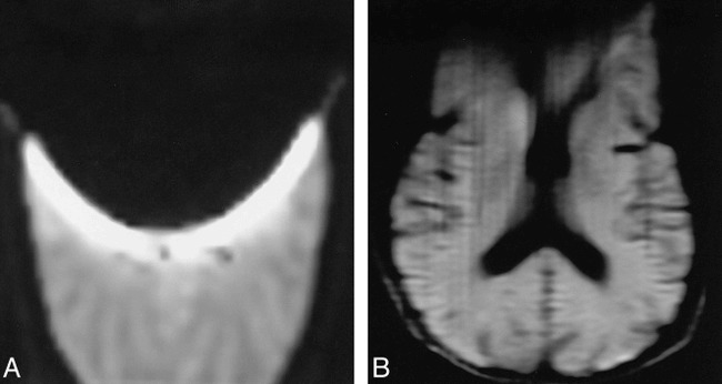 fig 2.