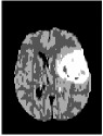 graphic file with name IJBI2019-7305832.tab2.i041.jpg