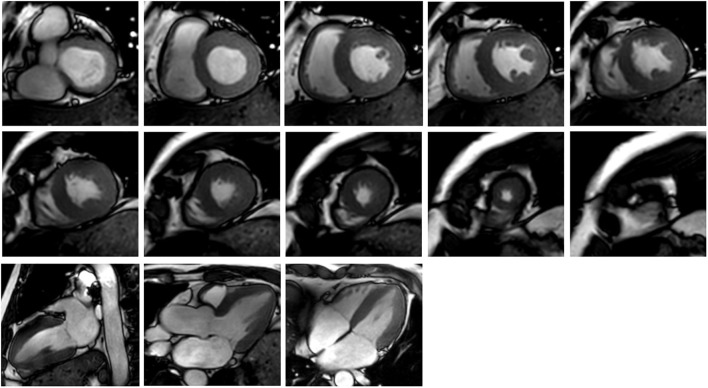 FIGURE 2