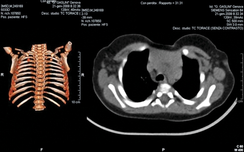 Figure 3: