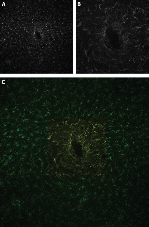 Figure 11