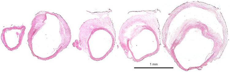 Figure 11.