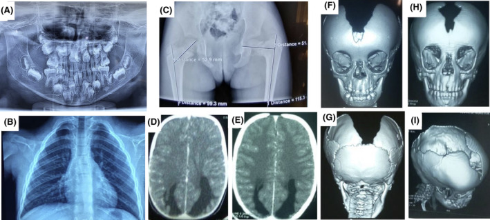 FIGURE 2