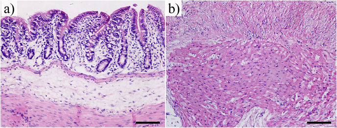 Fig. 11