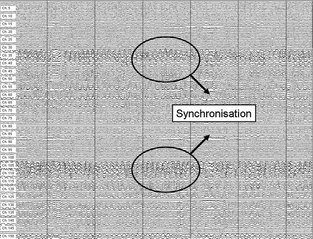 Fig. 2