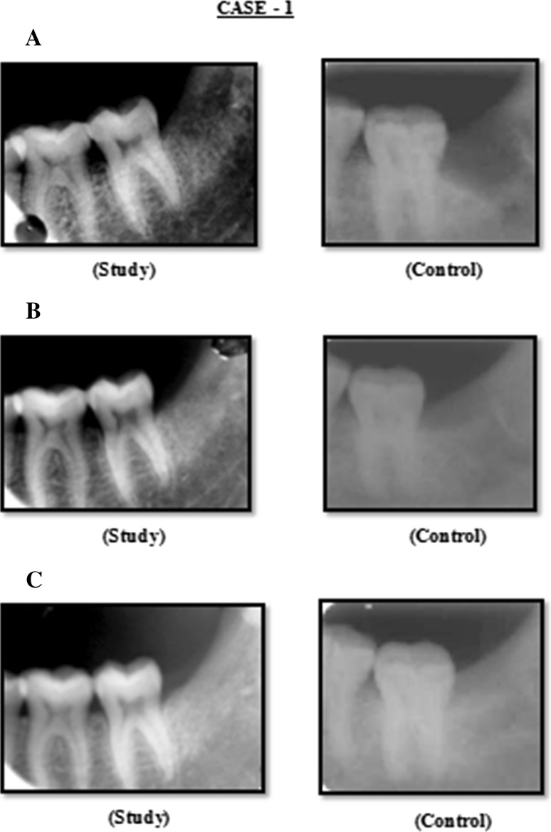 Fig. 1