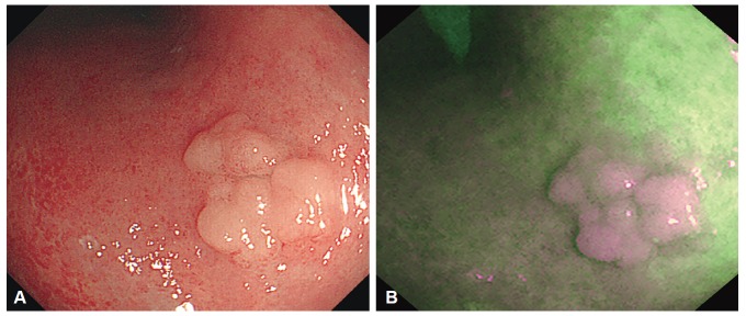 Fig. 2.