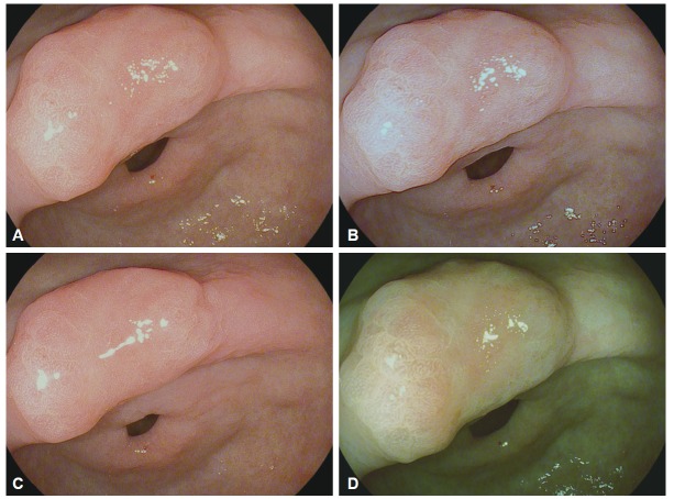 Fig. 5.