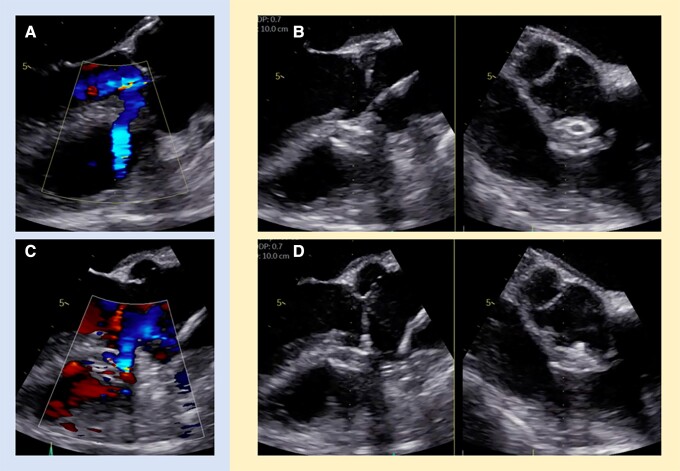 Figure 4