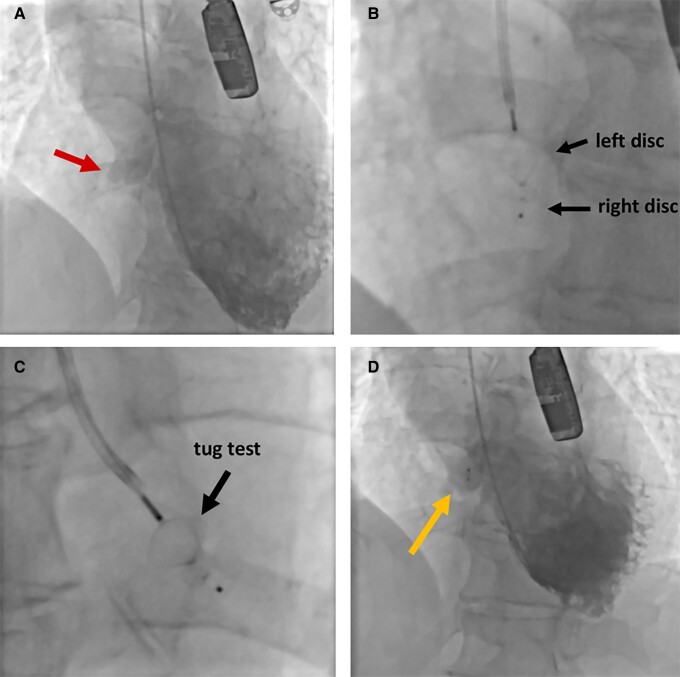 Figure 3