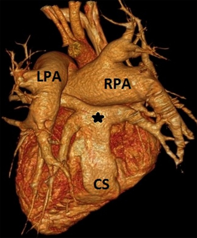 Figure 3