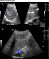 Fig 7