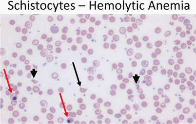 Fig. 11