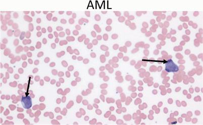 Fig. 13