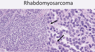 Fig. 20