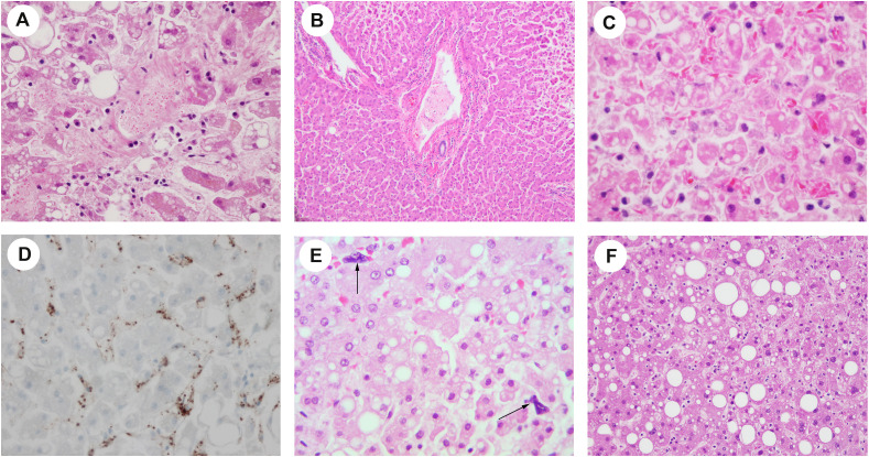 Fig. 1