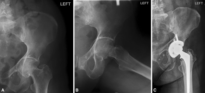 Fig. 4A–C