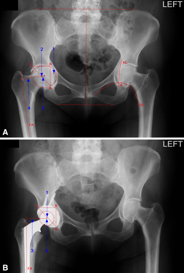 Fig. 1A–B