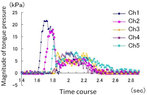 Figure 14.