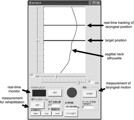 Figure 23.