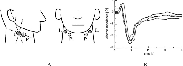 Figure 18.