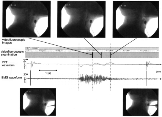 Figure 17.