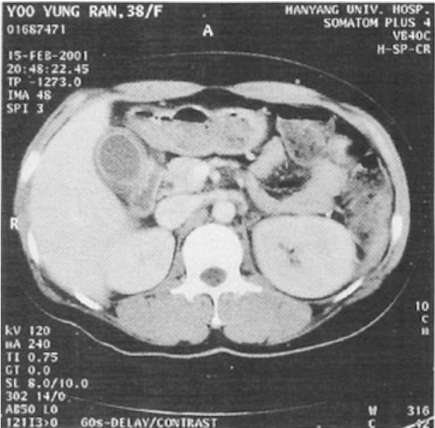 Figure 1-A.