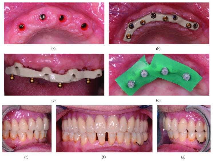 Figure 11