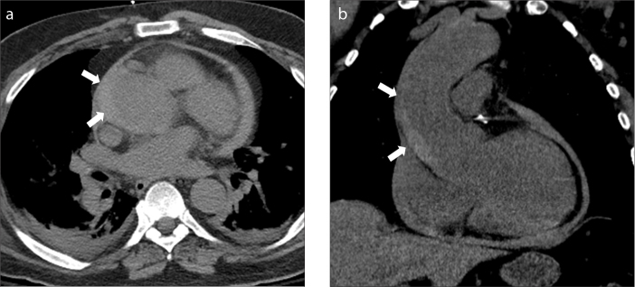 Figure 1. a, b