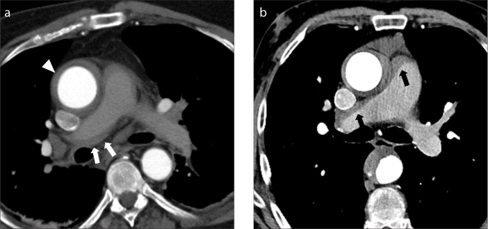 Figure 4. a, b