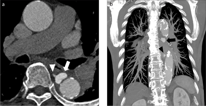 Figure 8. a, b