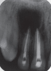 Figure 3A