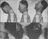 198