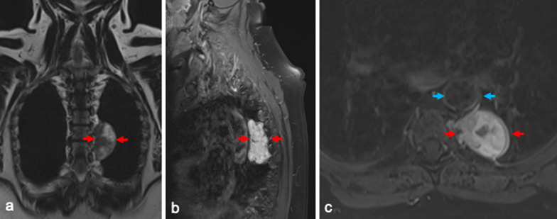 Fig. 1