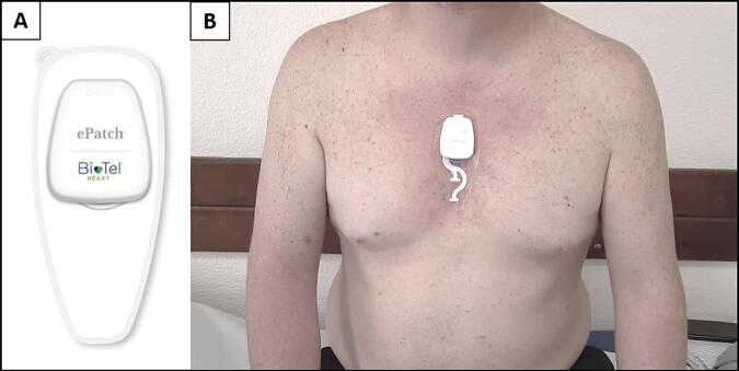 Fig. 1