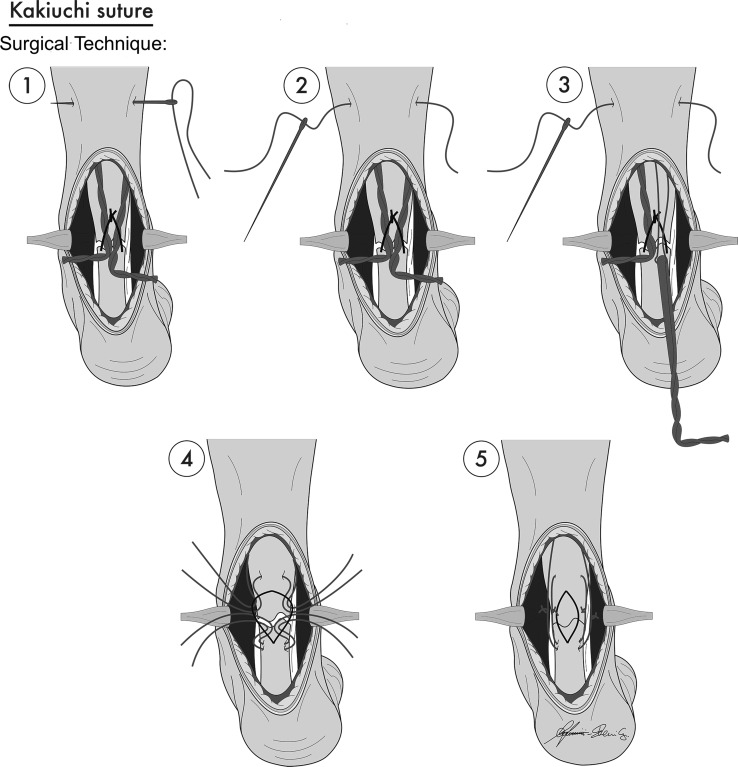 Fig. 1