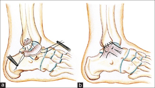 Figure 6