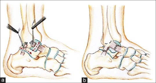 Figure 5