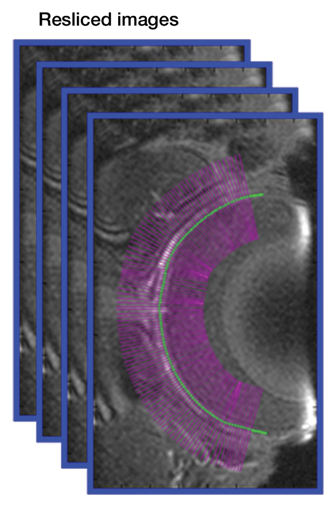 Figure 1c: