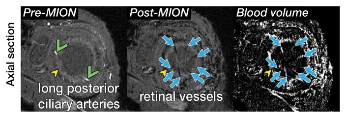 Figure 2a: