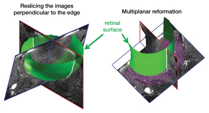 Figure 1b: