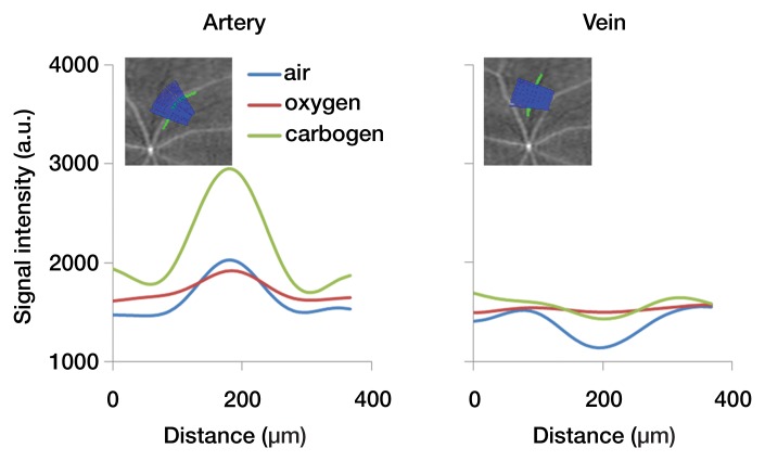 Figure 4b: