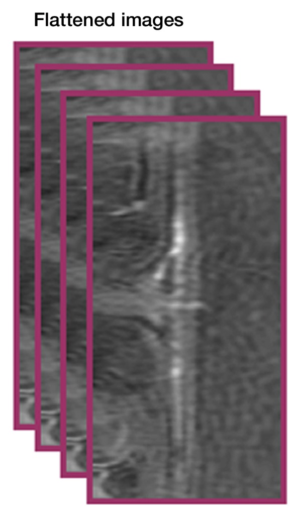 Figure 1d: