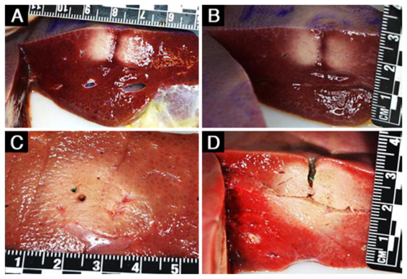 FIG. 4