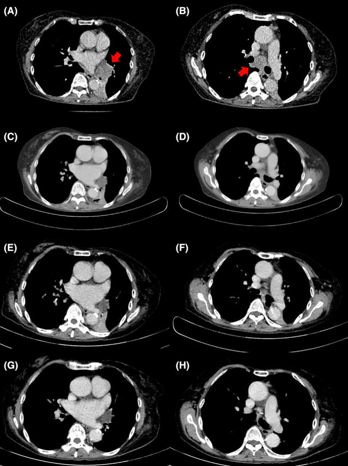 FIGURE 1