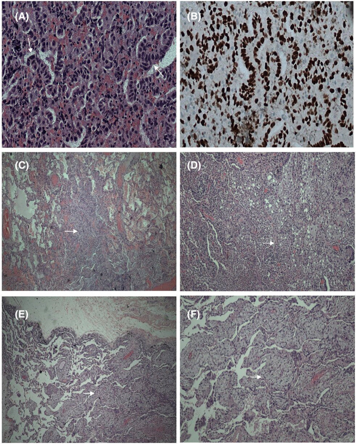 FIGURE 2