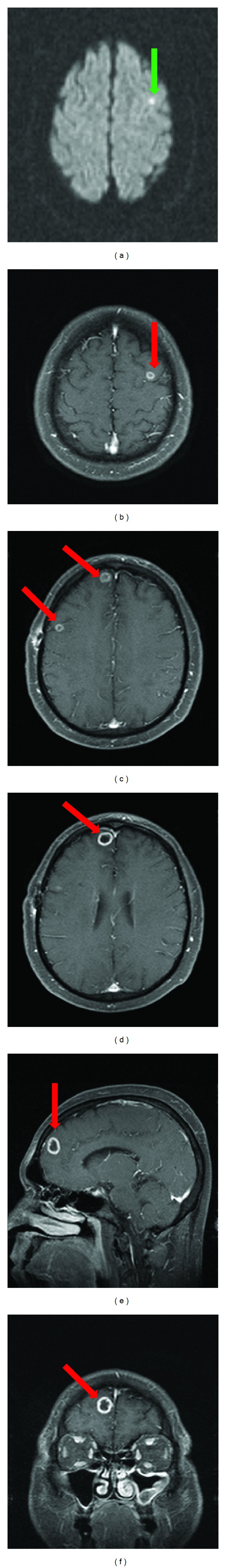 Figure 6