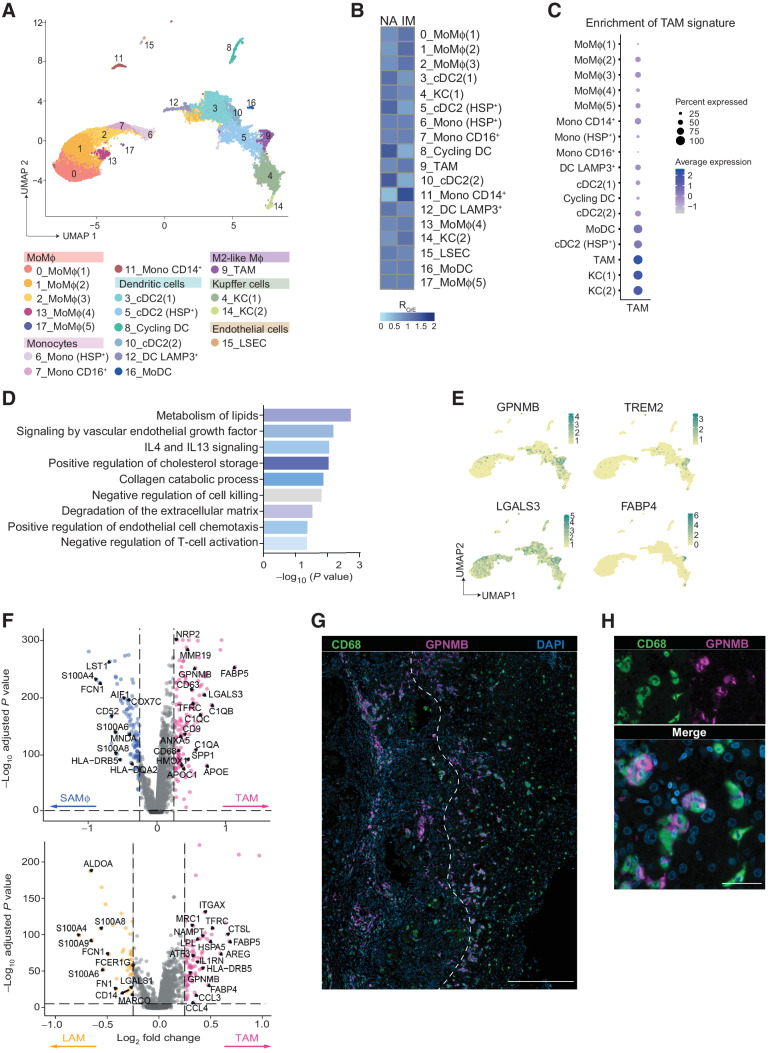 Figure 1. Identification of GPNMB+ TAMs in the IM of human CLM. scRNA-seq was performed on MP isolated as CD163+CD66b– cells from the NA and IM portions of 3 human CLM tissues. A, UMAP plot from integrated NA and IM analysis of 24,749 cells, color-coded by cluster assignment. B, Prevalence of each cluster in tissue (NA and IM) calculated by RO/E score. C, Dot plot showing scaled enrichment score of TAM gene signature across MP clusters in CLM. Circle size represents the proportion of cells expressing the TAM gene signature; color represents average signature expression in each cluster. D, Pathway enrichment analysis of TAM marker genes showing selected Gene Ontology annotations. Fisher exact test. E, UMAP representing gene expression of selected TAM marker genes across MP clusters. Clusters are colored according to normalized gene expression values. F, Volcano plot showing differentially expressed genes between TAMs vs. SAMϕs (ref. 28; top) and TAMs versus LAM (ref. 29; bottom). Exemplar genes are labelled. Purple genes represent up regulated genes and blue and yellow genes represent down regulated genes [log2(fold change) > |0.25| and adjusted P value < 0.05]. G, mf-IHC image of CLM section stained for CD68 (green) and GPNMB (magenta). Dashed line shows tumor margin. Picture is representative of n = 48 slides stained. Scale bar: 300 μm. H, mf-IHC image of CLM section stained for CD68 (green) and GPNMB (magenta). Picture is representative of n = 48 slides stained. Scale bar: 30 μm.