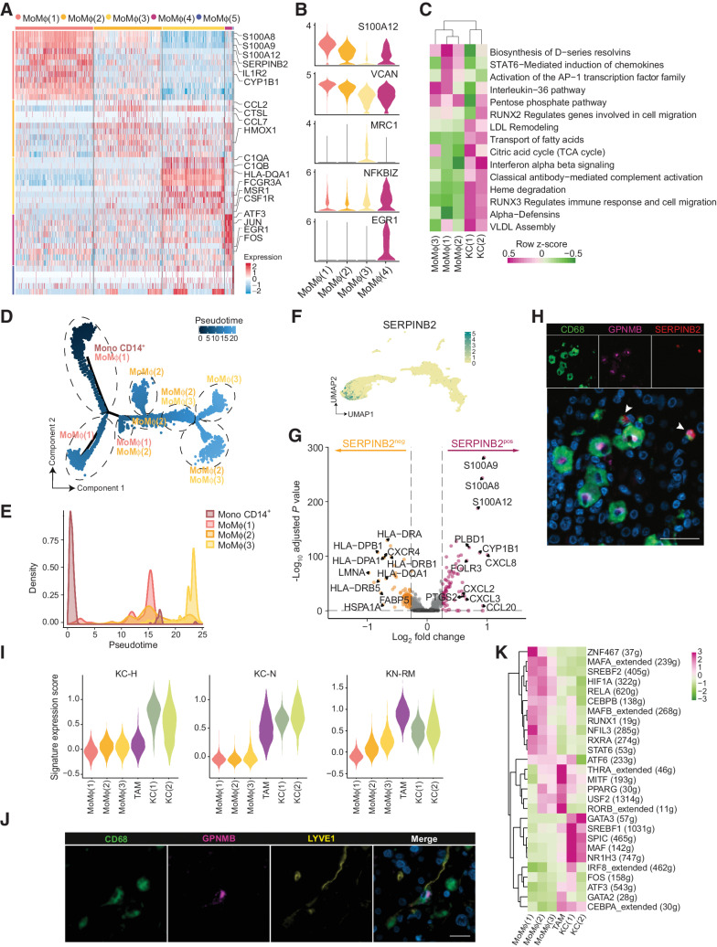 Figure 2. In-depth characterization of inflammatory MoMϕ subsets and TAMs in CLM. Functional characterization of selected scRNA-seq MP clusters. A, Heat map of differentially expressed genes in MoMϕ(1–5) clusters, color-coded by cluster. Exemplar genes are labelled. Rows represent marker genes. Columns represent individual cells. B, Violin plots of marker gene expression and abundance across MoMϕ clusters. C, Enrichment score in MoMϕ(1–3) and KC(1–2) clusters of selected pathways from GSVA analysis. D, Monocle pseudotemporal trajectory (light blue to dark blue) of Mono CD14+ and MoMϕ(1–3) clusters in a two-dimensional state-space. Dashed lines mark the different transcriptional states. Labels represent prevalent clusters within transcriptional state. E, Density plot representing cluster frequency along pseudotime. F, UMAP plot of the 18 clusters color-coded by SERPINB2 expression. Clusters are colored according to normalized gene expression values. G, Volcano plot showing differentially expressed genes between SERPINB2pos and SERPINB2neg cells from clusters MoMϕ(1) and MoMϕ(2). Exemplar genes are labelled. Red and orange dots represent genes up regulated in SERPINB2pos and SERPINB2neg, respectively, with log2(fold change) ≥ 0.5 and adjusted P value < 0.05. H, mf-IHC image of CLM section stained for CD68 (green), GPNMB (magenta), and SERPINB2 (red). Arrows indicate SERPINB2+CD68+ cells. Representative picture of n = 5 slides stained. Scale bar: 50 μm. I, Violin plots showing enrichment score of KC-H, KC-N, KN-RM gene signatures (47) across selected MP clusters. One-way ANOVA P < 0.0001 by Kruskal–Wallis test. J, mf-IHC image of CLM section stained for CD68 (green), GPNMB (magenta), and LYVE1 (yellow). Representative picture of n = 3 slides stained. Scale bar: 20 μm. K, Heat map of gene regulatory network activity of selected MP clusters computed by SCENIC.