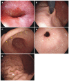 Figure 16